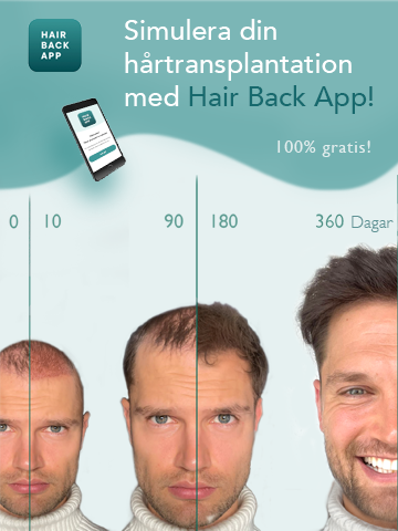 Hair_loss_app_preview